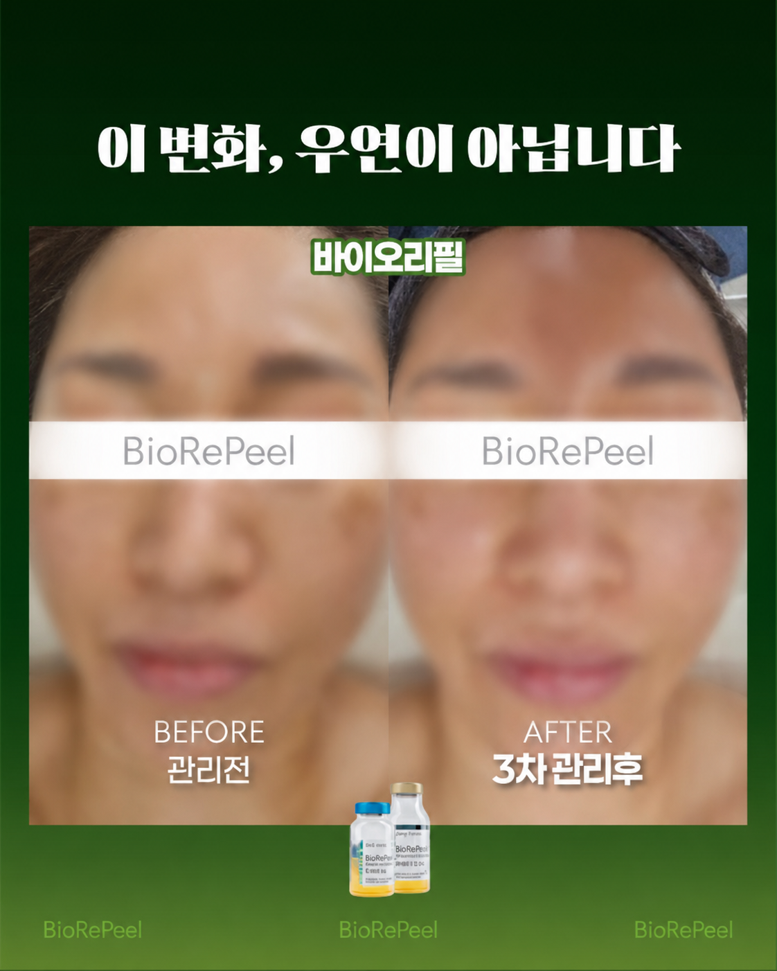 외국인 고객에게 관리 정보를 안내할 때 활용할 수 있는 바이오리필 얼굴 관리 사례