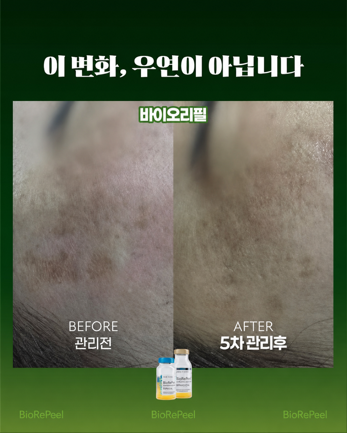 피부샵 메뉴 설명에 활용할 수 있는 바이오리필 피부 관리 사례